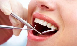 Giải đáp các thắc mắc hàng ngày về Răng hàm mặt