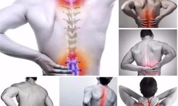 Cải thiện  bệnh xương khớp, đau dây thần kinh bằng phương pháp đông y hiệu quả