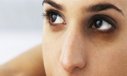 6 cách hữu hiệu cho đôi mắt hết thâm đen