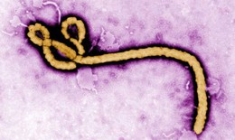Ebola có lây qua đường tình dục?