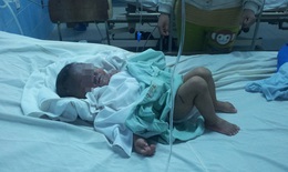 Bé 20 tháng tuổi bỏng nặng bởi nồi cháo của mẹ