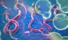 Sự nguy hiểm của virut Ebola