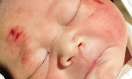 Mẹ nguy kịch vì bị tai nạn giao thông vẫn cố đẻ con trước khi qua đời