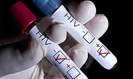 Vi phạm quy định về xét nghiệm HIV, xử lý thế nào?