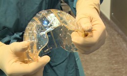 Lần đầu tiên trên thế giới thay toàn bộ hộp sọ nhờ công nghệ in 3D