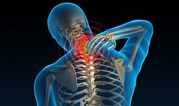 Triệu chứng thoái hóa đốt sống cổ