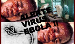 Một ca bệnh nhiễm virut Ebola là một ổ dịch
