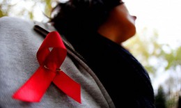 Có được công khai hình ảnh người nhiễm HIV khi chưa được phép?