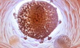 Lần đầu tiên “xóa sổ” virus HIV trong DNA của người