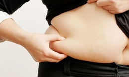 Thừa cân, béo phì là nguyên nhân dẫn tới bệnh ung thư