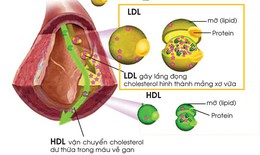 Thận trọng khi dùng thuốc hạ mỡ máu rosuvastatin