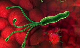 Nhiễm tr&#249;ng Helicobacter Pylori ở dạ d&#224;y