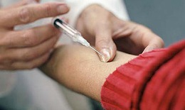 Tiêm tĩnh mạch tôi có thể gây sốc phản vệ