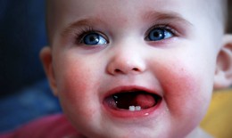 Trẻ mọc răng: Những điều cần chú ý