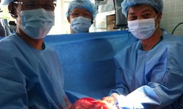 Phẫu thuật u sợi thần kinh khổng lồ trong lồng ngực sản phụ