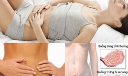 U nang buồng trứng, bệnh thường gặp của phụ nữ