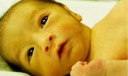 Phân biệt vàng da sinh lý và vàng da bệnh lý ở trẻ sơ sinh