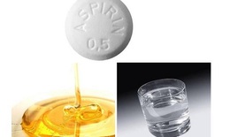 Những trường hợp không nên dùng thuốc aspirin