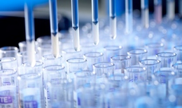 Thiết bị mới xét nghiệm HIV