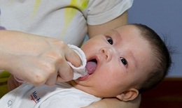 Nhận biết bệnh nhiễm nấm lưỡi ở trẻ em