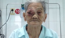 Phẫu thuật u hốc mắt cho Mẹ Việt Nam Anh hùng 101 tuổi