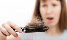 Chọn thuốc trị rụng tóc thể hói