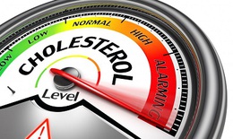 Cholesterol - Thủ phạm làm tăng di căn ung thư tuyến tiền liệt