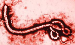 Tìm ra 'gót chân Achilles' của virus Ebola