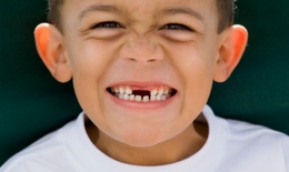 Hiểu về quá trình thay răng của bé