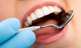 Những thời điểm tuyệt đối tránh đi nhổ răng