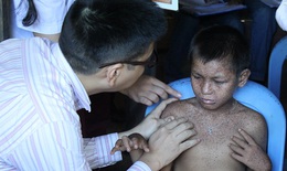 “Bệnh lạ" ở Phú Thọ là bệnh khô da sắc tố