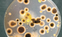 Ph&#242;ng ngừa vi&#234;m phổi do nhiễm vi khuẩn Legionella