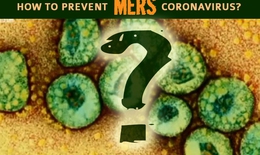 Phòng ngừa lây nhiễm MERS-CoV trong bệnh viện thế nào?