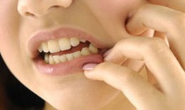 Răng khôn khi nào phải nhổ?