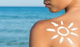 Cách đơn giản sơ cứu làn da cháy nắng