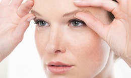 Ðiều trị sụp mi mắt