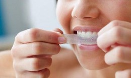 Tẩy trắng có làm hại răng không?