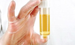 Tiểu ra máu và buốt, bệnh gì?