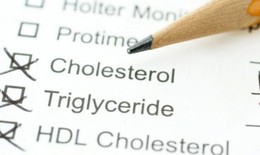 Hàm lượng cholesterol có thể liên quan tới đau gân