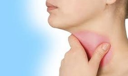Cách chữa bệnh viêm họng đúng