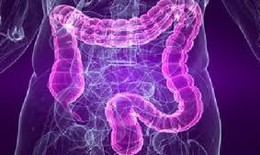 Hướng mới trong điều trị hội chứng ruột kích thích