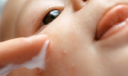 Viêm da mủ - Bệnh của mùa hè