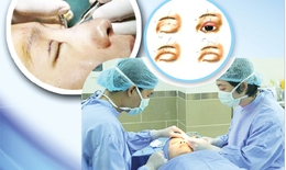 Phẫu thuật mí mắt - Coi chừng “thảm họa”