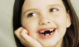 Tại sao trẻ cần được điều trị chỉnh hình răng hàm mặt sớm?
