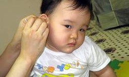 Nấm ống tai ở trẻ em