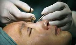 Điều cần biết về phẫu thuật sụp mi mắt, xăm mi và xóa nếp nhăn mắt