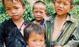 Hôn nhân cận huyết thống: Nguyên nhân làm suy giảm sức khỏe