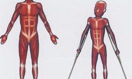 Triển vọng ứng dụng liệu ph&#225;p gen điều trị bệnh loạn dưỡng cơ Duchenne