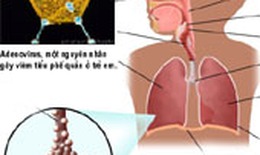 Virut hợp bào gây viêm phổi ở trẻ em
