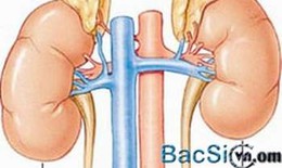 Cách tránh tái phát hội chứng Cushing
